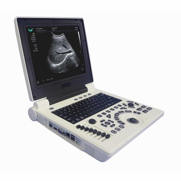 Quality USG OB GYN Portable USG Machine IMT Automatic Measurement for sale