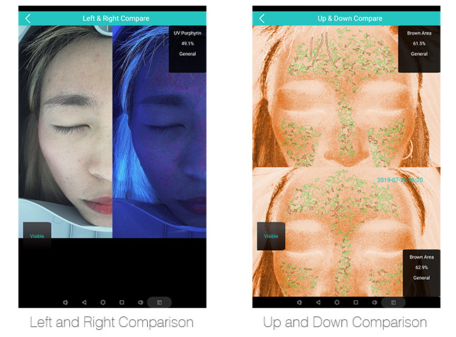 Home Skin Hair Testing Analysis Machine 3d Digital Observe Abs Material