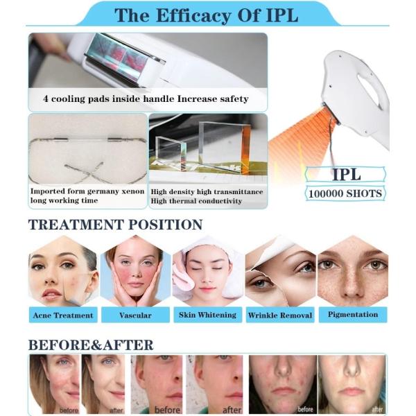 Multifunctional 3 handles ipl laser hair removal machine by Beijing Nubway laser ipl hair