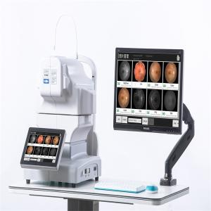 Autoexposure Automated Fundus Camera FFA Non Mydriatic