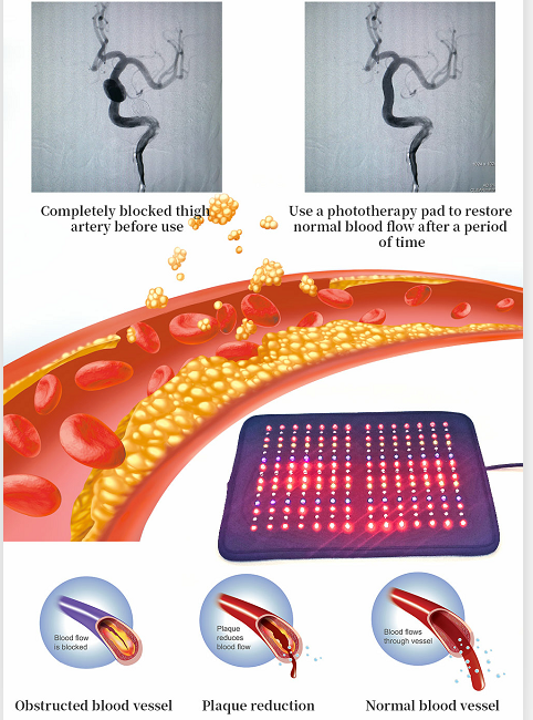 660nm 810nm LED Belt LED Mat Colors Light Therapy Pad System Clinics Use