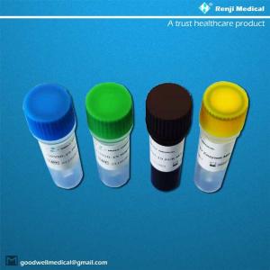 RNA 2019-NCoV Detection Kit 95% Sensitivity  60 Min Workflow