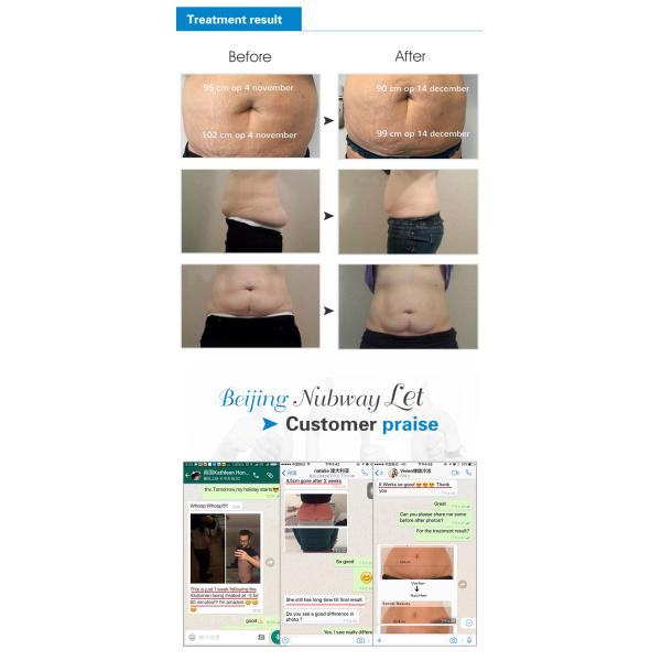 cool tech fat freezing machine for whole body fat reduce