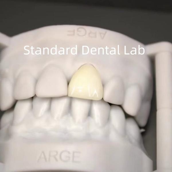 Quality Digital CAD CAM Dental Lab Crowns Translucent Layered Zirconia Crown for sale