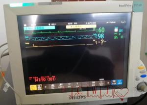 China 2nd Hand 50mm/S Hospital Monitoring System , 12 Inch Icu Bedside Monitor wholesale