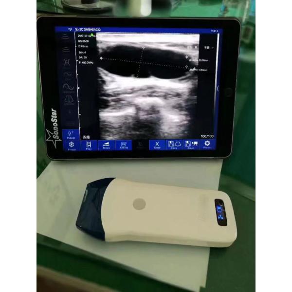 Medical 128 Element Wireless Handheld Color Doppler Linear Ultrasound Probe Built-in Lithium Battery