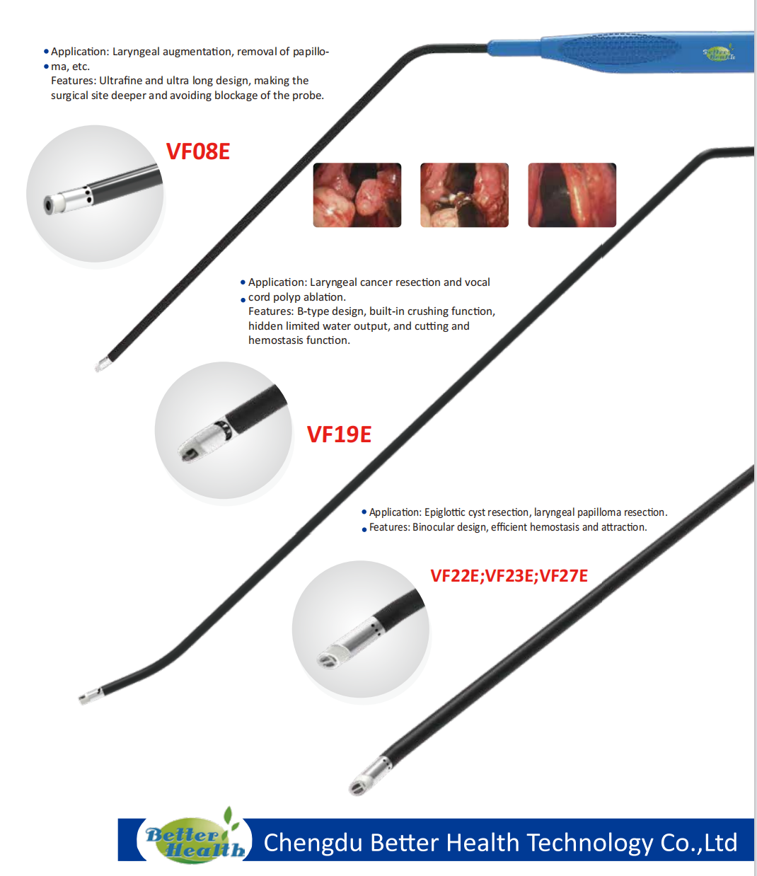 Radio Frequency Coblation Plasma Surgery System Snoring Treatment