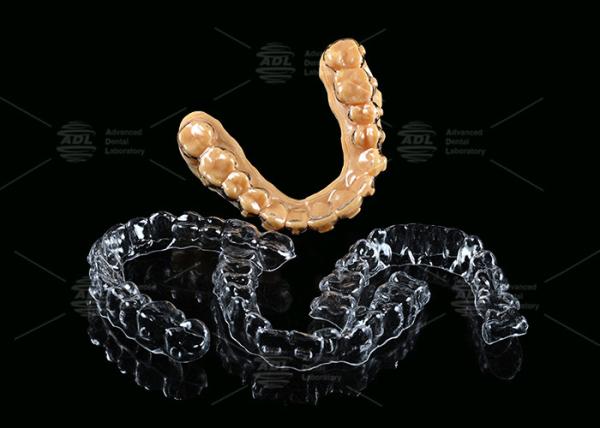 Quality Customizable Invisible Aligner Clear Aligner With Shorter Treatment Time for sale
