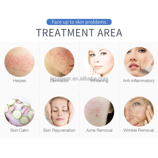 PDT Ultrasonic Facial Massager 50-60Hz 60hz Ultrasonic Skin Massager