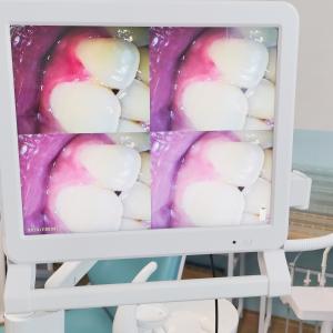 Dental Endoscope With 17 Inch Monitor Wifi Handheld Portable Dental Camera Intraoral Endoscope Intra Oral Camera