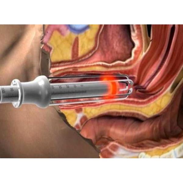 rf driver fractional co2 laser acne and stretch marks removal