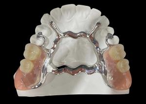 China Metal Base and Acrylic Resin Partial Removable Denture for a Secure Fit and Natural Appearance wholesale