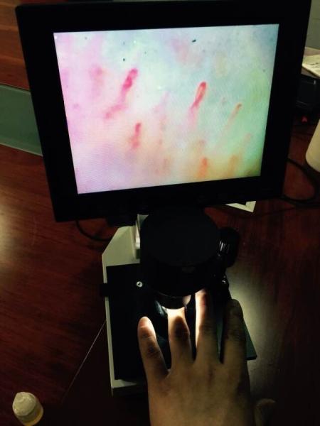 Quality Magnification 400 Times Digital Microcirculation Microscope Nailfold Microcirculation Equipment for sale