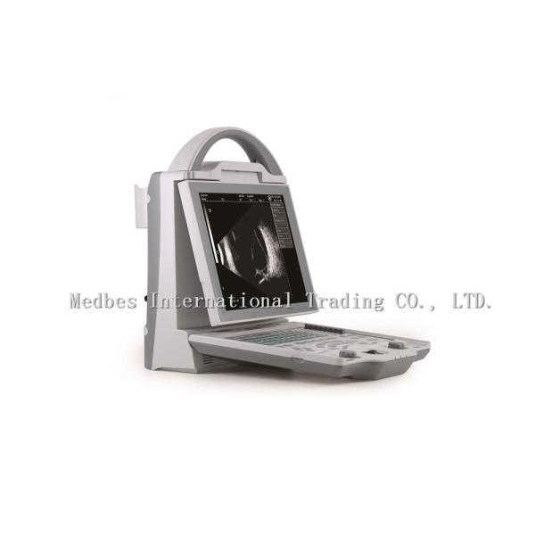 Top Sale Laptop Ophthalmic AB Mode Ultrasound Scanner Equipment