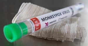 China Monkeypox Virus Detection Reagent Real Time PCR Kit wholesale