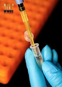 China NT-ProBNP Rapid Test Kit Fluorescence Immunoassay Cardiac Testing wholesale