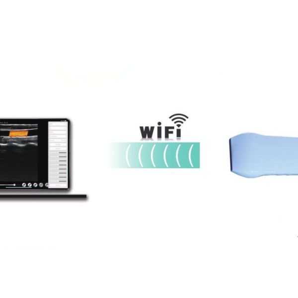 Color Doppler Probe 128 Elements Handheld Ultrasound Device Wifi Connected to Mobilephone