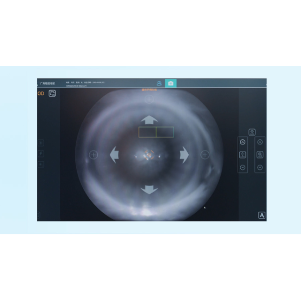True Color Wide Field Fundus Camera with 8μm Optical Resolution and 27-inch HD Color Monitor for Retinal Imaging