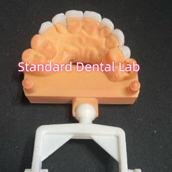 Quality Natural Looking Laminate Zirconia Emax Veneers Thikness 0.6mm for sale