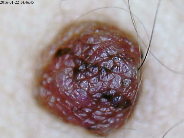 Hair Analyer Video Dermatoscope Observing Skin And Hair With 200 Times Magnification Stored Picures in SD Card