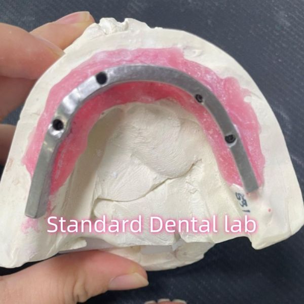 Esthetic Restoration All On 4 Dental Implants Zirconia Hypo Allergenic