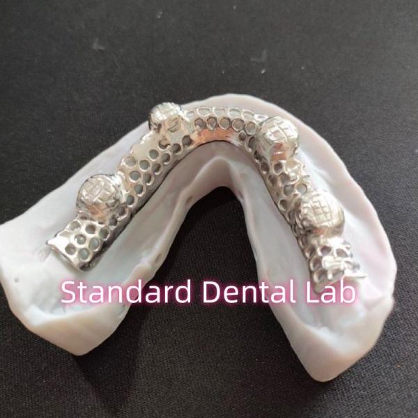 Quality Cast Cobalt Chrome Metal Framework Partial Denture With Metal Frame for sale