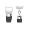 Titanium / Cobalt Chromium Dental Implant Rod Comfortable Highly Biocompatible Implant for sale