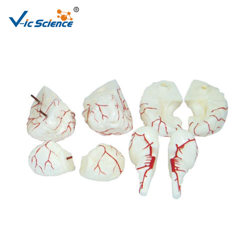 Brain With Arteries Human Anatomical Model For Teaching , 18.5x14x13.5CM