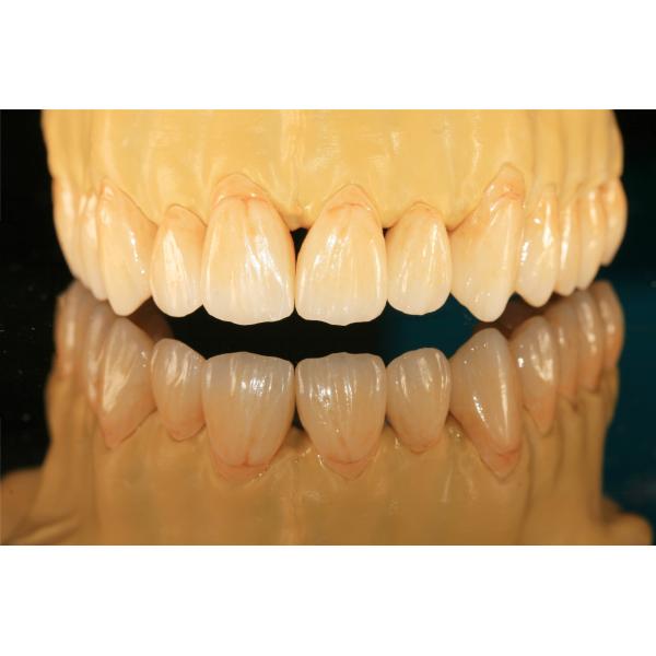 Prosthetic Dentistry Full Zirconium Oxide Crown 5 Stars Design Dental Lab