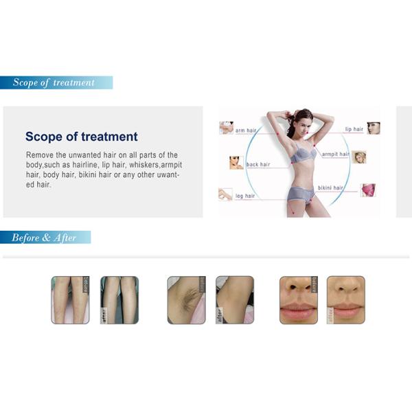 hot newest Germany 808nm diodes laser hair removal product