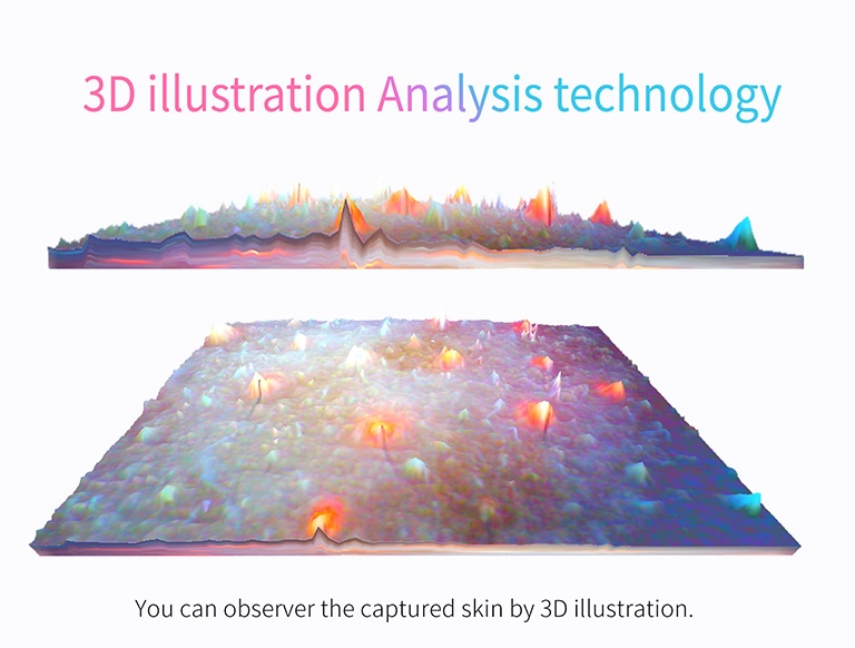 Skin Analyzer with 36 Million Pixels Camera and Pigmentation Analysis Function at Design