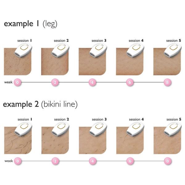 Portable Ipl Hair Removal Mini Laser Hair Removal 3 In 1 Painless Permanent