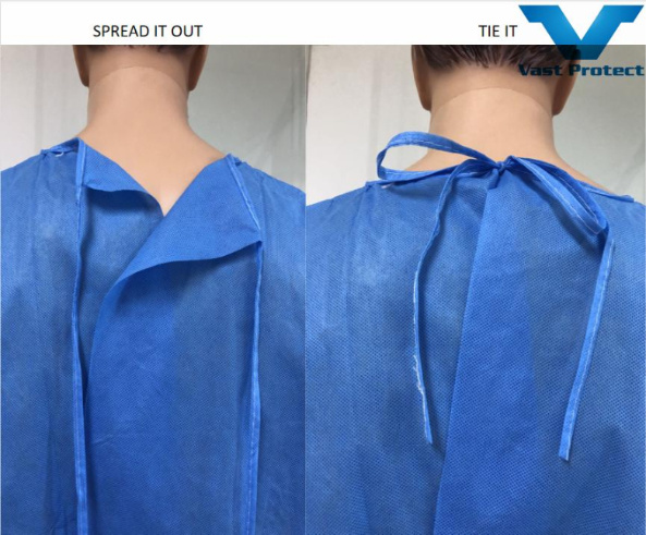 Cheap Disposable Medical Supplies Fluid Resistant Non-Sterile SMS Isolation Gown