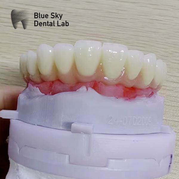Quality Nature Implant Procedure Cases with Universal Compatibility and Optimal Performance for sale