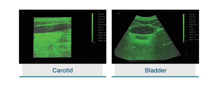 Digital Human Veterinary Portable Ultrasound Machine Ultrasound Portable Ultrasound