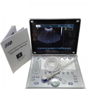 China Laptop Black And White Portable Ultrasound Scanner With 2 Probe Connector And 3D Optional wholesale