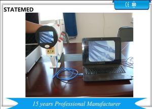 China Veterinary Portable X Ray Device 100mm Output Image Stable High Efficiency wholesale