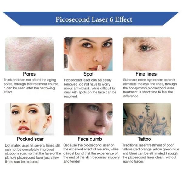 755nm 532nm picolaser Laser Tattoo Removal Machine 1064nm Microdermabrasion Device