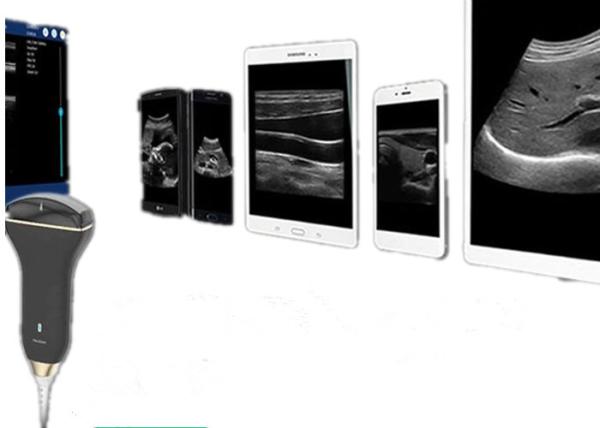 Quality USB Ultrasound Probe Handheld Doppler Machine Supported Windows Android for sale