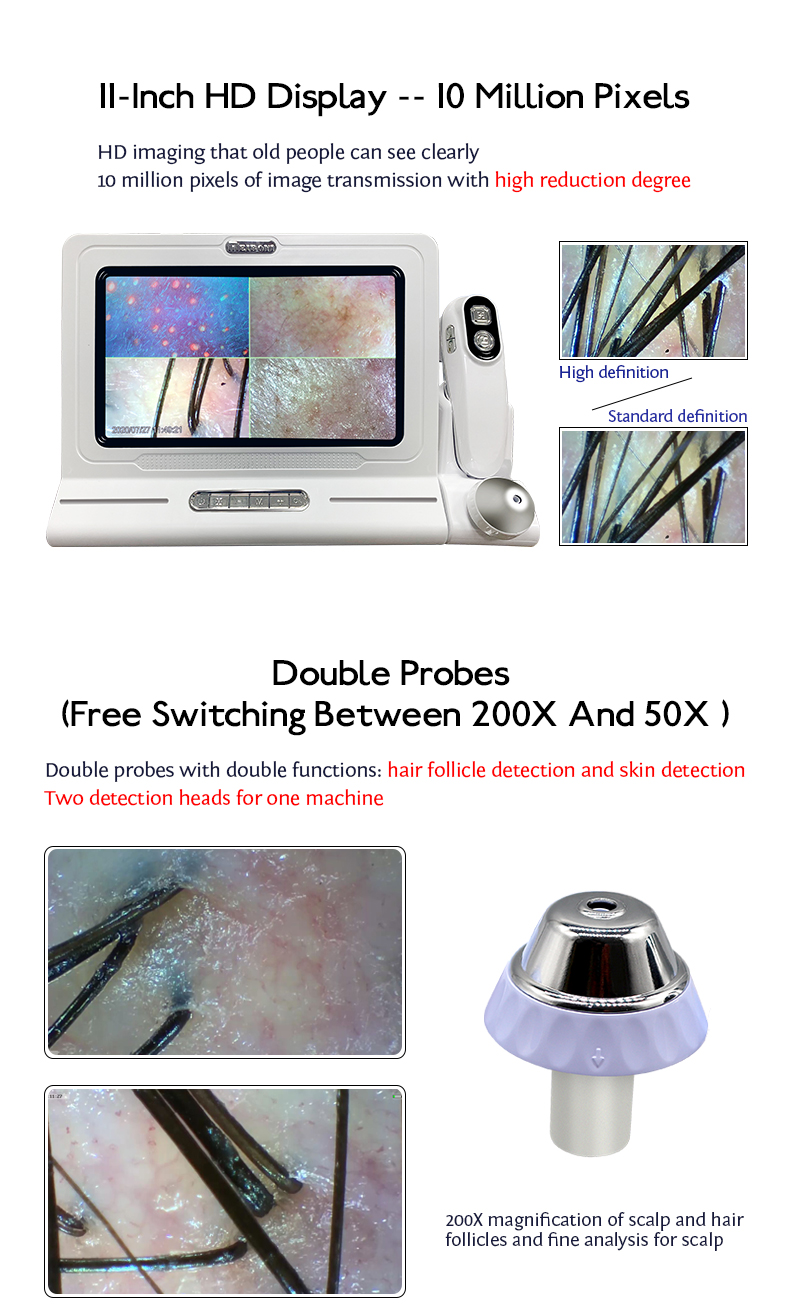 Desktop Scalp Analysis Care Machine for Skin Hair and Follicle Analysis For Commercial