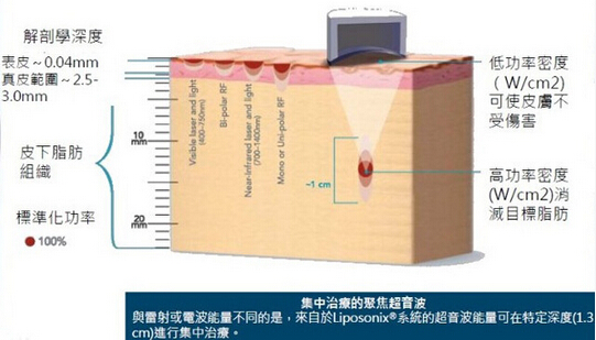 FDA approval vertical new arrival best selling HIFUshape slimming machine