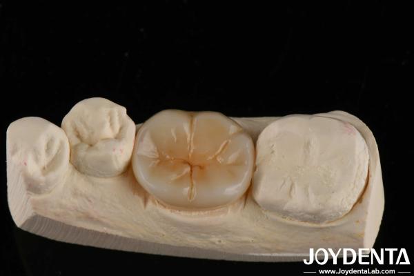 Quality 800 MPa Flexural Strength And 8 MPa·m1/2 Fracture Toughness In Multilayer Full Zirconia For Strength Applications for sale