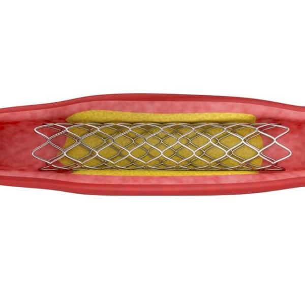 Excellent Mechanical Properties Elastic Alloy Wire 3j53 Wire 0.2mm / Strip For Elastic Connector