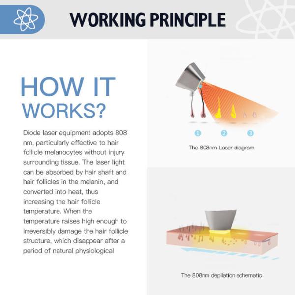 Foldable Alexandrite Laser Hair Removal Machine Permanent 808 Diode Laser Machine