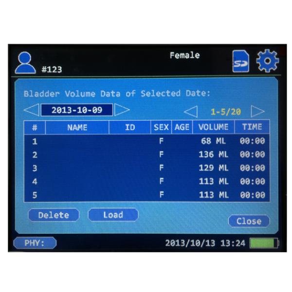 Touch Screen ultrasound bladder scanner ,bladder scanner with one A probe built in battery