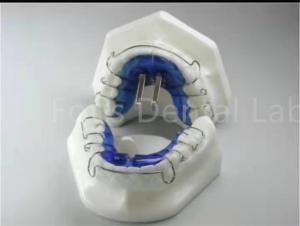 Orthodontic Treatment Retainer Expander For Precise Teeth Alignment