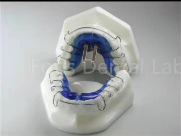 Quality Orthodontic Treatment Retainer Expander For Precise Teeth Alignment for sale