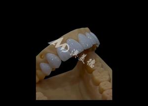 Prosthetic Dentistry Zirconia Dental Crown Precise Fit Aesthetics For full arch teeth