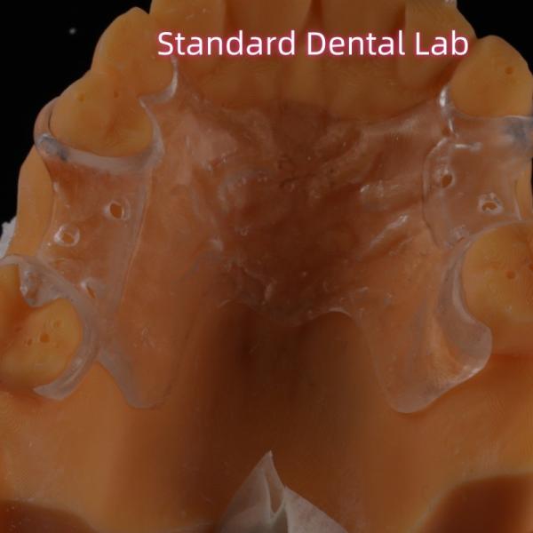 Quality Removable Clear Acrylic Partial Denture Clasps Retentive Natural Looking for sale