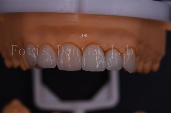 Quality 1 Day Digital Crowns Excellent Compatibility With Easy Transmission Via Email Or Software for sale